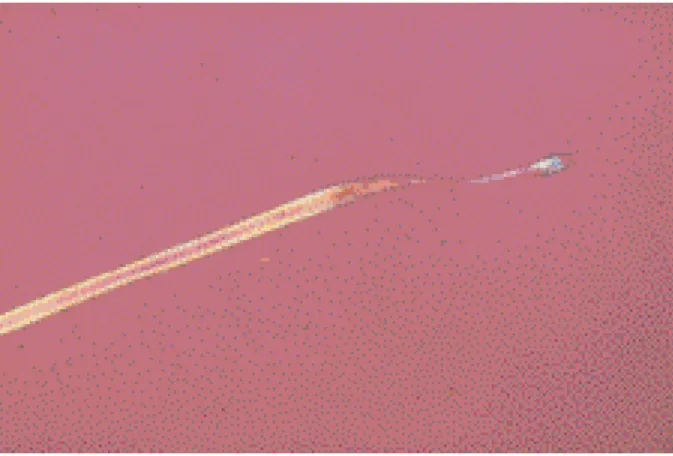 Fig. 3 : Aspects microscopiques typiques d’alopécies induites par des cytostatiques.