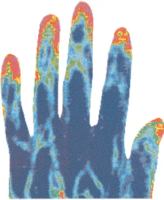 Fig. 3. Aspect d’une main en vélocimétrie laser Doppler.