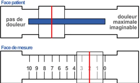 Figure 2. Echelle visuelle analogique (source : Google image) 