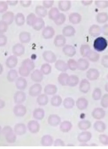 Figure 2 : Observation au microscope d’hématies, d’un lymphocyte et de quelques plaquettes 