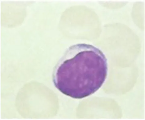 Figure 7: Observation d'un lymphocyte au microscope 