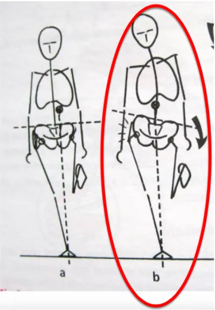 Figure   3   :   a   =   Appui   monopodal   stable,   b   =   Boiterie   de   Tredelenburg    (Anatomie   fonctionnelle   de   la   hanche,   E.Poinsot,   R.Ballas)   