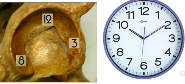 Figure   16   :   Analyse   scanner   du   positionnement   du   cotyle   (TAL   :   Ligament   