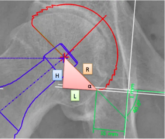 Figure   28   :   Calcul   du   positionnement   du   centre   de   rotation       