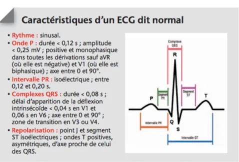Figure 1 Caractéristiques d'un ECG normal(5) 