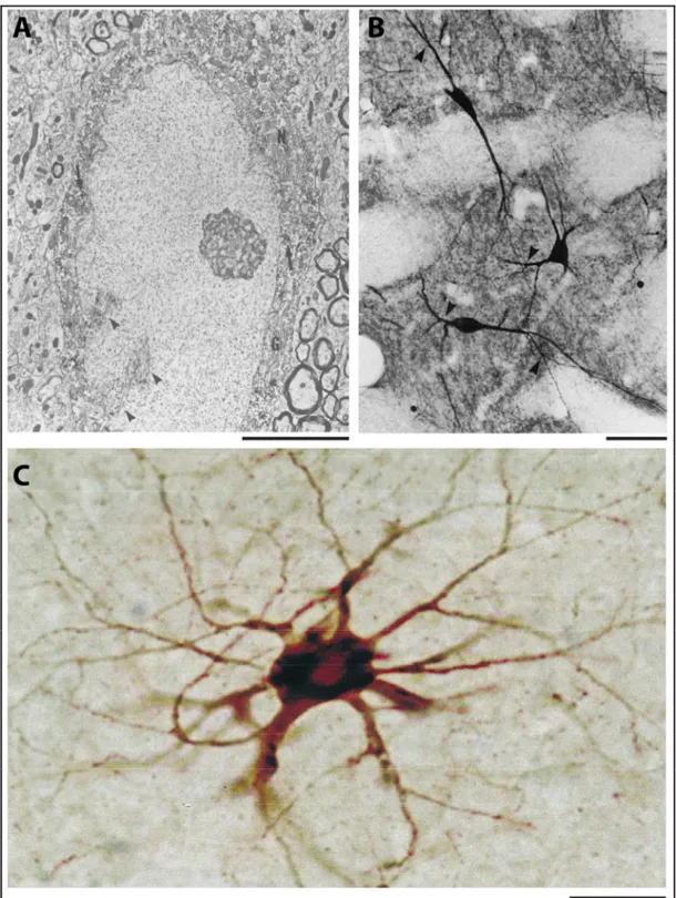 Figure 1.7. Morphologie des interneurones cholinergiques du striatum chez le rat et l’humain
