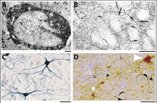 Figure 1.9. Morphologie des interneurones NADPH+ chez le rat et l'humain. A) Caractéris- Caractéris-tiques ultrastructurales de l’enveloppe nucléaire (N pour nucleus) d’un interneurone NADPH+ dans  le striatum dorsal chez le rat, [Modifiée de (Sancesario e
