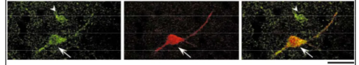 Figure 1.15. Expression du récepteur D 5  par les interneurones CR+ chez le rat. Colocalisation  du récepteur D 5  (vert) au sein des interneurones immunoréactifs pour la CR (rouge) par  immunohis-tochimie dans le striatum dorsal chez le rat, [Modifiée de 