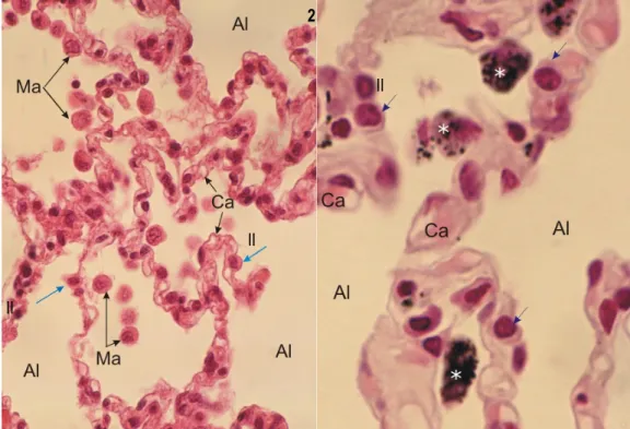 Figure  1.6.  Alvéoles  pulmonaires  en  microscopie  optique  x450  (1)  et  x1000  (2)  colorée  à  l’hématoxyline- l’hématoxyline-éosine
