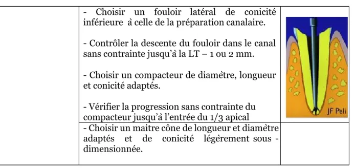 Tableau VII :  Fiche de procédure E14 Cfore (obturation canalaire mixte)  -  Choisir  un  fouloir  latéral  de  conicité  inférieure  à celle de la préparation canalaire