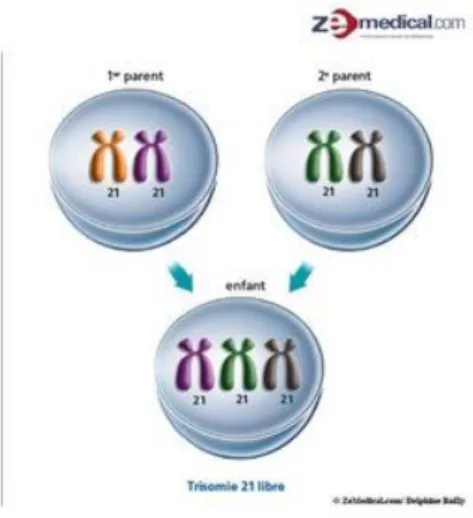 Figure 1: Phénomène de non-disjonction méiotique expliquant la constitution de la trisomie 21 libre 