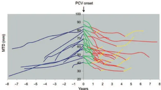 Figure D. Evolution du diamètre tumoral moyen (DTM) avant, pendant, et après  chimiothérapie par PCV