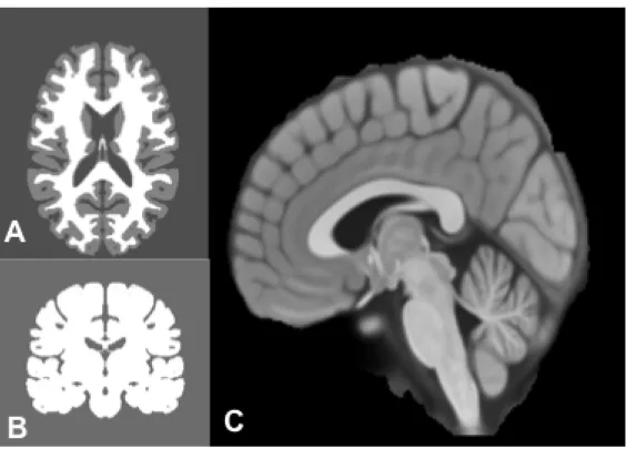 Figure 11: Atlas cérébral INM: masque substance blanche et grise (A et C), masque LCR (B) 