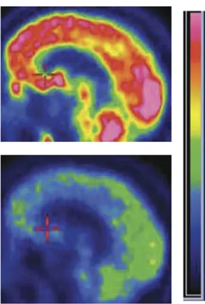 FIGURE CREDIT: IMAGE ADAPTED FROM FIGURE 8 IN  WILLIAMS ET AL., 2013.