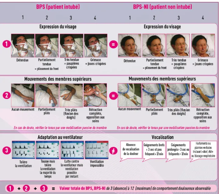 Figure 3 : Echelles Behavorial Pain Scale et BPS-NI adaptée pour le patient non intubé,  d’après [1,8] 