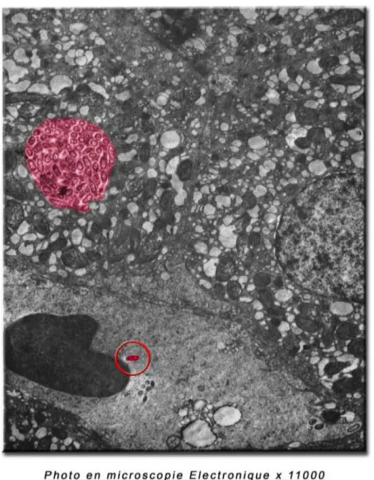 Figure 4 : Présence de C. burnetii au sein d'une vacuole parasitophore dans une cellule  infectée 