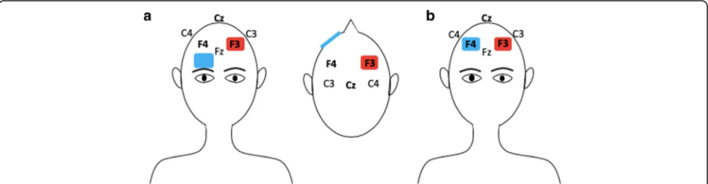 Fig. 3 Anodal stimulation of left dorsolateral prefrontal cortex (DLPFC). Figure a: reference electrode positioned over the contralateral supraorbital region