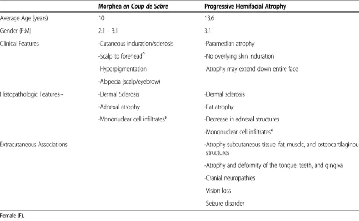 Figure 13 : Tableau comparatif entre SLCS et SPR   [5] 