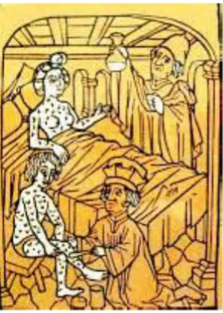 Tableau illustrant la syphilis au XVIe siècle 