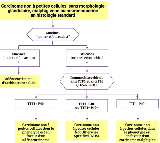 Figure  I-1 :  Démarche  diagnostique  anatomopathologique  devant  un  cancer  broncho- broncho-pulmonaire primitif sans signe morphologique de différenciation  