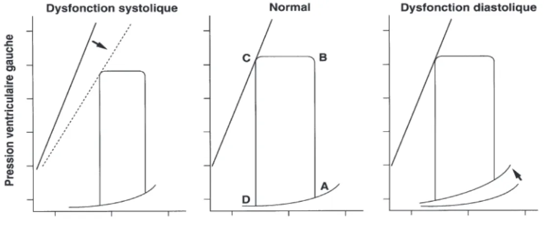 Figure 1: exemples de courbes pression-volume 
