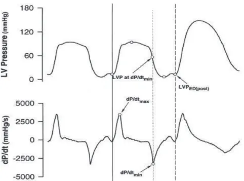 Figure  3:  Courbes  de  cathétérisme  représentant  la  pression  ventriculaire  gauche  en  fonction  du  temps  (en  haut),  la  dP/dt en fonction du temps (en bas) .La dP/dt minimale est corrélée à la relaxation du ventricule gauche 