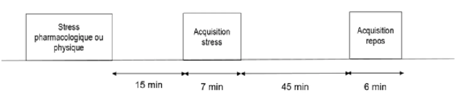 Figure 9. Protocole d’acquisition de l'étude Gimelli et al. (29)  