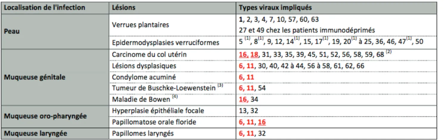 Figure 1 : Différents types de lésions cutanéo-muueuses et génotypes viraux associés [4] 