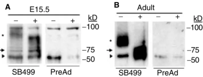 Fig. 2. Differential expression of ClC-5 and AQP1 in the developing mouse kidney: semi-quantitative and real-time PCR analysis