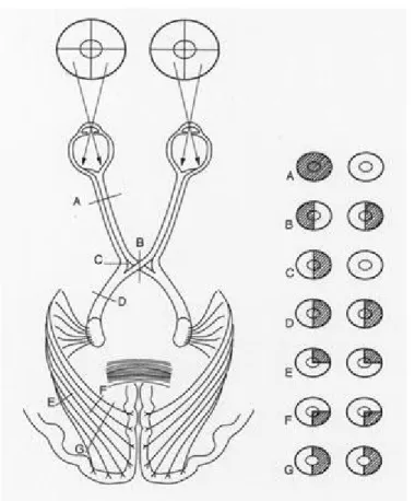 Figure 7: Les voies optiques et leurs déficits  23