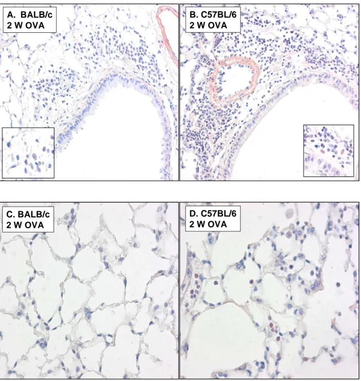 Figure  3:  Airway  histology  (Congo  Red  stainings)  of  OVA-  sensitized  and  -challenged  BALB/c  (A)  and  C57BL/6 (B) mice (2 weeks OVA exposure; magnification size = x 200)