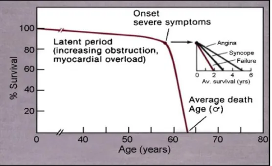 Figure 01: Histoire naturelle du rétrécissement aortique serré 