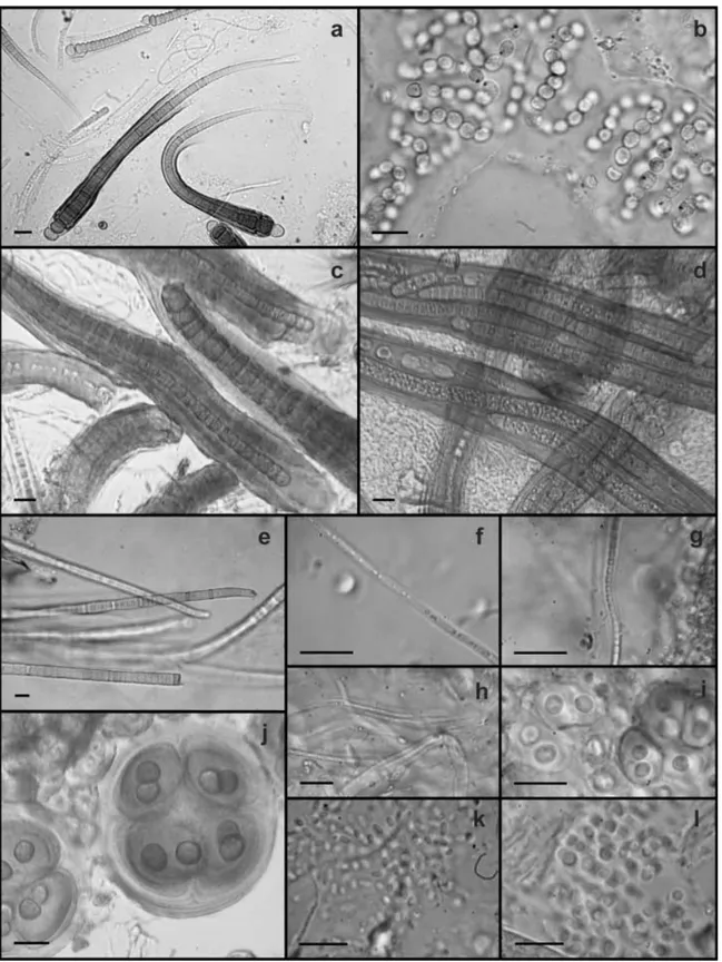 Fig. 5 Common cyanobacterial morphotypes found in the microbial mats of the study lakes