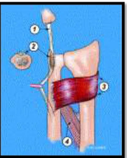 Figure 12. Extrinsec stabilizers of the DRUJ include the tendon of the extensor carpi ulnaris (1), the    sixth  dorsal  compartment  subsheath  (2),  the  pronator  quadratus  (3)  and  the  interosseous  membrane of the forearm (4). 