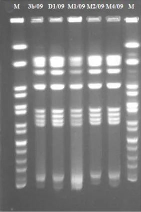 Figure 2c: Pulsed Field Gel Electrophoresis (PFGE) pattern of the  S. Sangalkam isolates with  restriction using Xba1 in the study area 