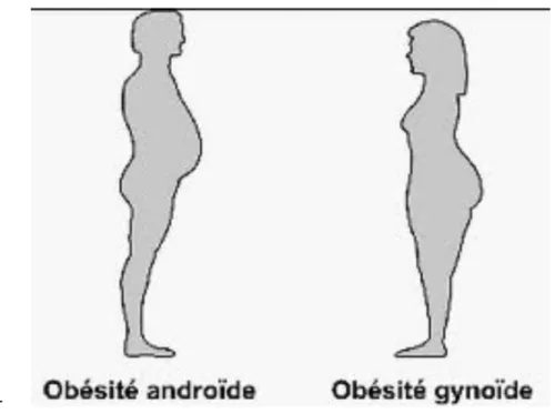 Figure 3: Deux types d'obésité 