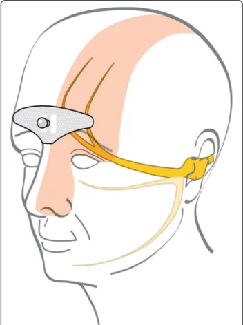 Figure 1 Area covered by the tSNS electrode.