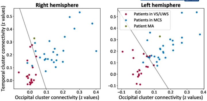 FIGURE 5  The contribution of each hemisphere to the state of consciousness. For patient MA (green), the isolated right hemisphere was  closer to the class of patients in vegetative state/unresponsive wakefulness syndrome (VS/UWS, in red; showing reflexive