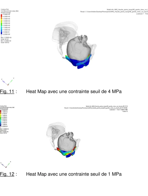 Fig. 11 :       Heat Map avec une contrainte seuil de 4 MPa 