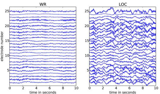 Fig 1. Two 10sec EEG segments from 25 channels. The segment in the left panel is during wakeful rest (WR) and the segment in the right panel is during propofol-induced loss of consciousness (LOC); both segments are shown after pre-processing