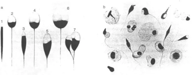 Figure  3 :  Tableau  récapitulatif  des  anomalies  morphologiques  du  spermatozoïde  selon  la  classification  de  David modifiée selon Auger et Eustache