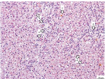 Fig. 1    Liver histopathology of calf no. 3 (hematoxylin and eosin  staining) showing severe degeneration associated with a disruption of  the parenchyma, fibrosis (a), biliary hyperplasia (b), cholestasis (c),  steatosis (d), and infiltration of lymphocy