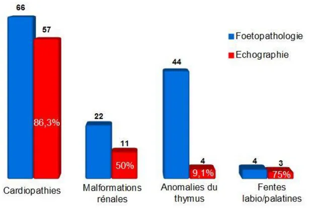 Figure 9: Concordance entre l'examen fœtopathologique et l'examen échocardiographique sur  les 83 fœtus ayant eu les 2 examens 