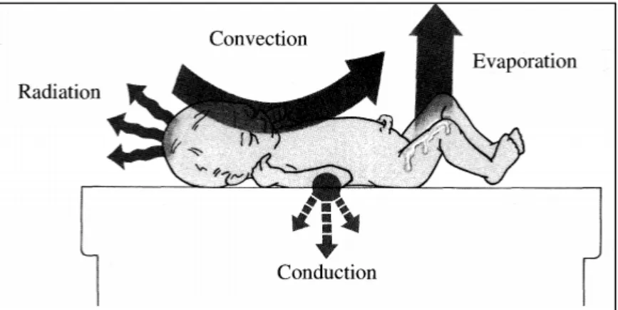 Figure 2 : Les 4 mécanismes de perte thermique du nouveau-né,  OMS, La protection thermique du nouveau-né : guide pratique 