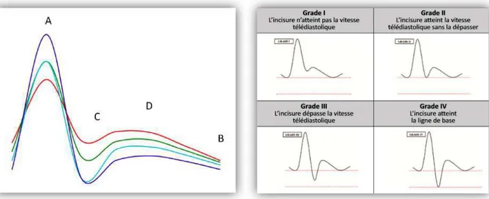 Figure 9: Classification des notchs  Figure 10: Classification des notchs (suite) 