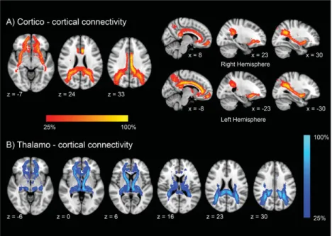 FIGURE 1: Group probability maps of reconstructed tracts in the healthy participants. Maps are thresholded at presence in at least 25% of the subjects