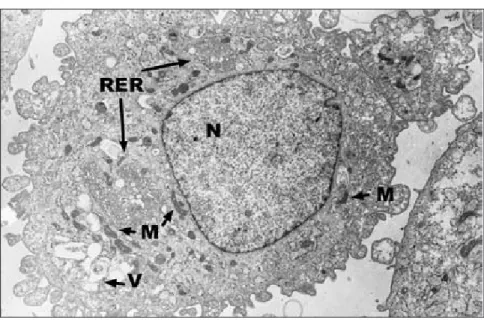 Figure 4 : Image d’un synoviocyte articulaire équin de type fibroblastique isolé à partir d’une culture  en monocouche par microscopie électronique en transmission