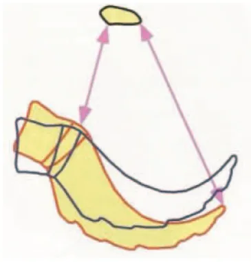 Figure 10 : nutation (Mécanique et techniques obstétricales de J.-P Schaal) 