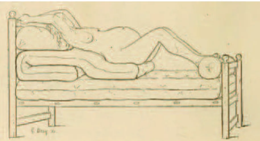 Figure 14 : lit de misère moderne (Histoire des accouchements chez tous les peuples de G.-J