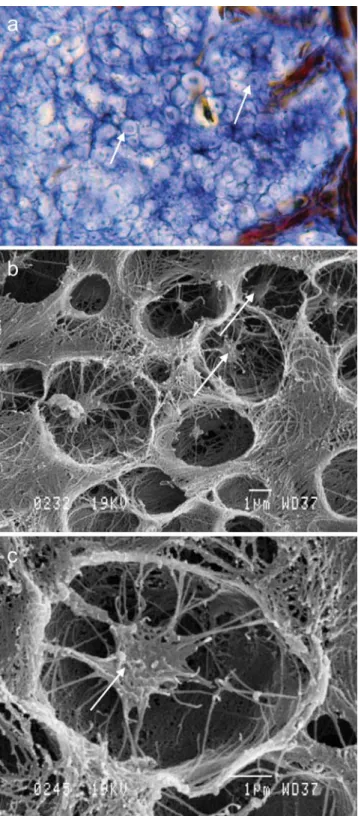 Fig. 6 Back-scattered electron imaging (under SEM) of the mineral part of the spherules (white) in the rocker bone of O